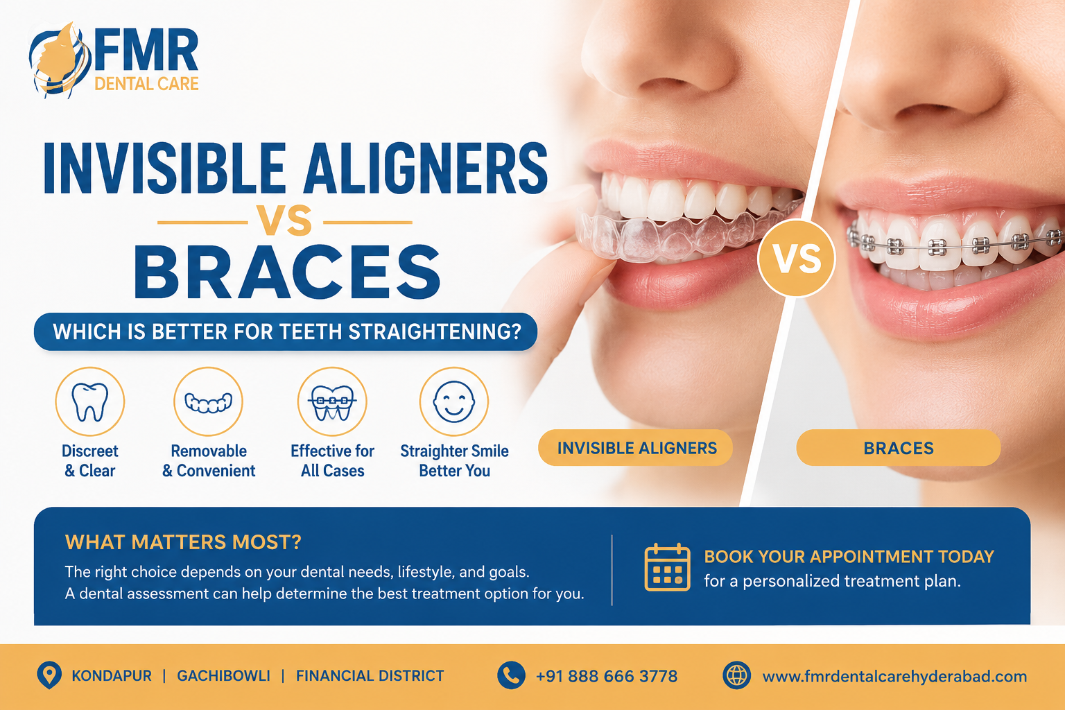 Invisible Aligners vs Braces